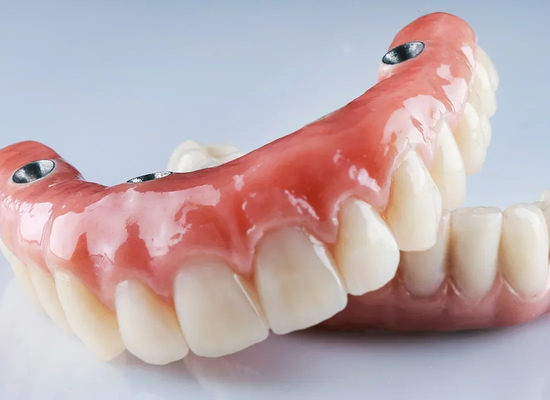 What is Full and Partial Dentures