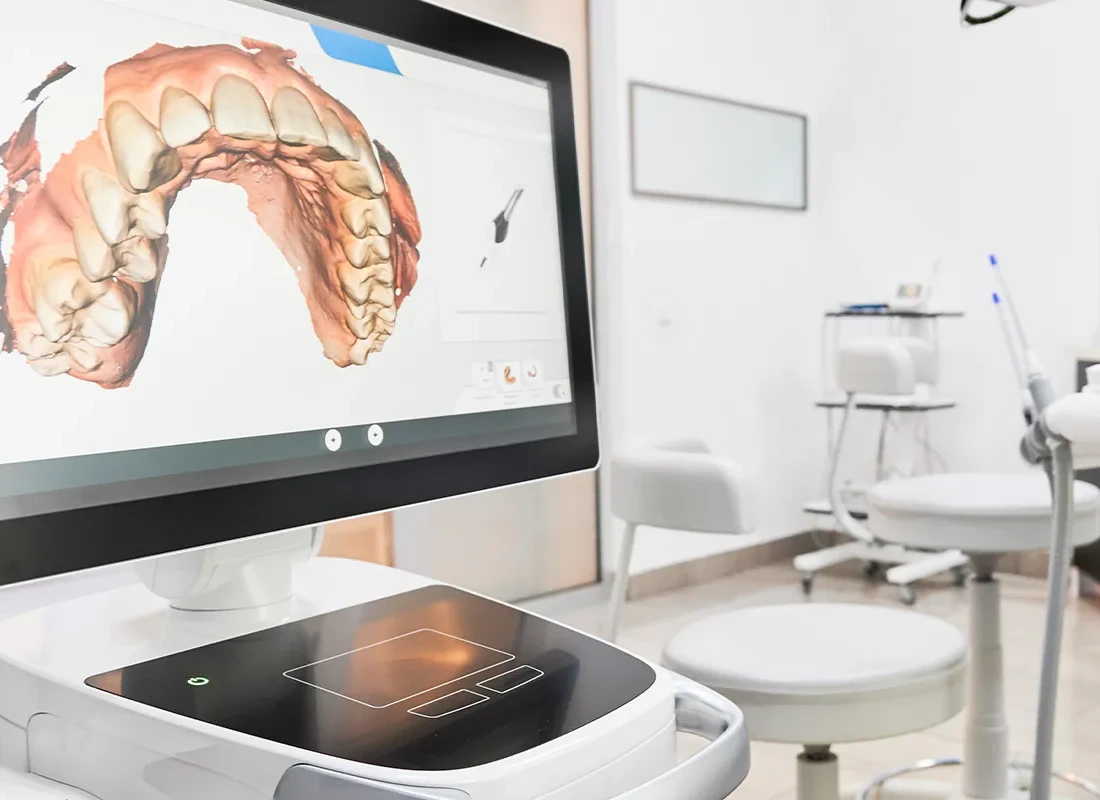 What is Laser Fillings