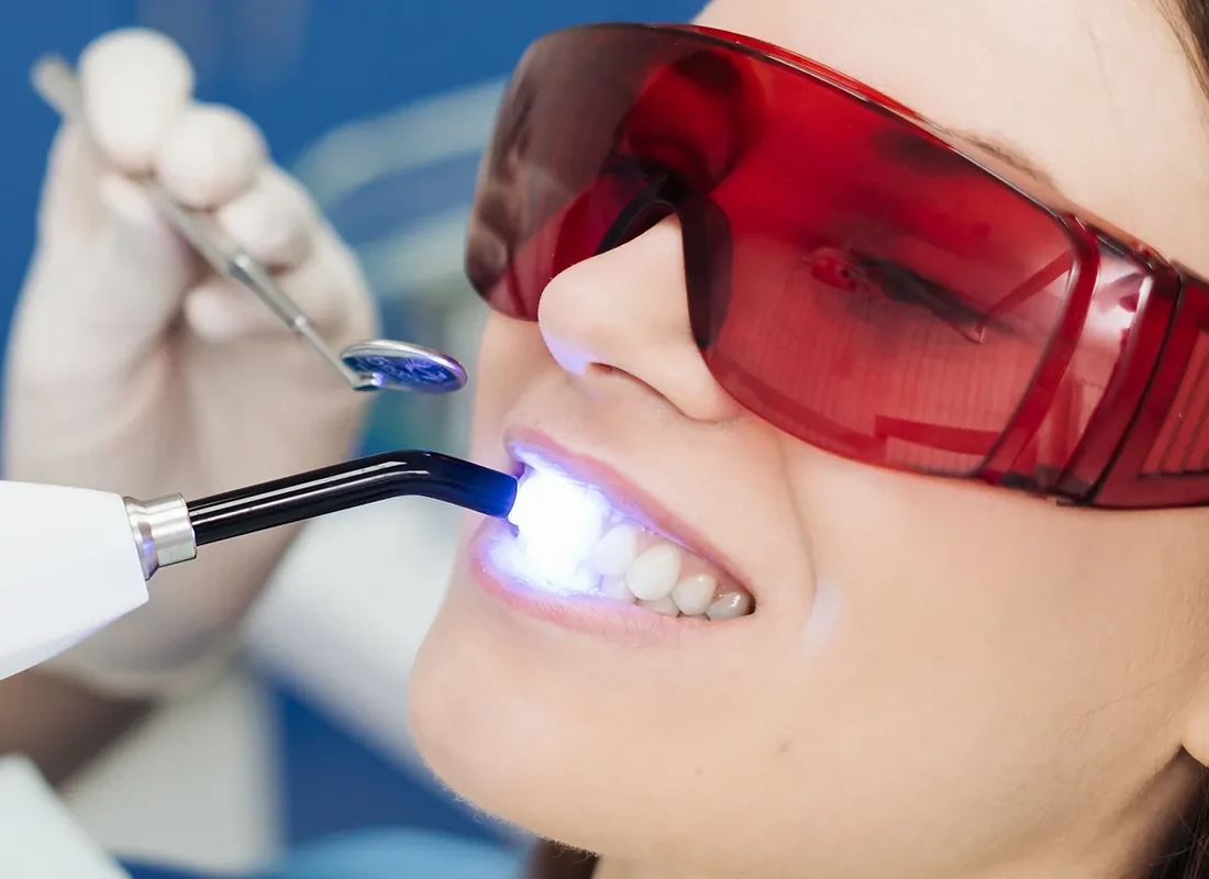 What is Solea Laser Dentistry
