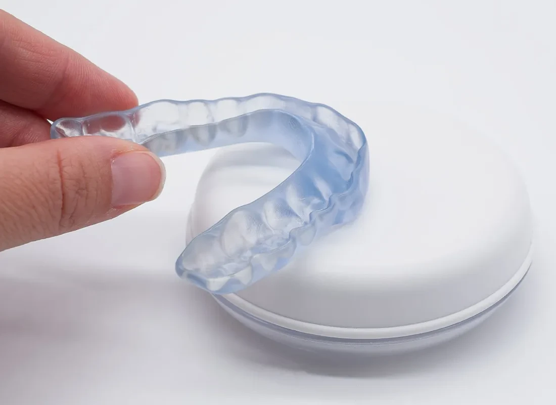 What is Retainers