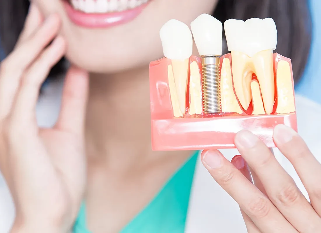 Reviewing dental implant options at Elite Dentistry